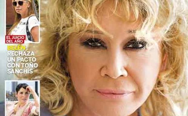 Así es la nueva cara de Mila Ximénez