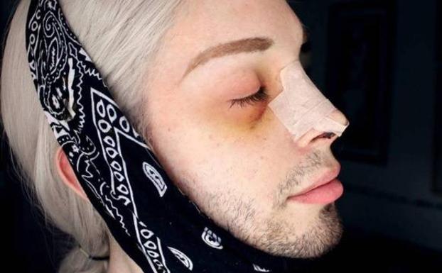 Un joven gasta todos sus ahorros para parecer un elfo