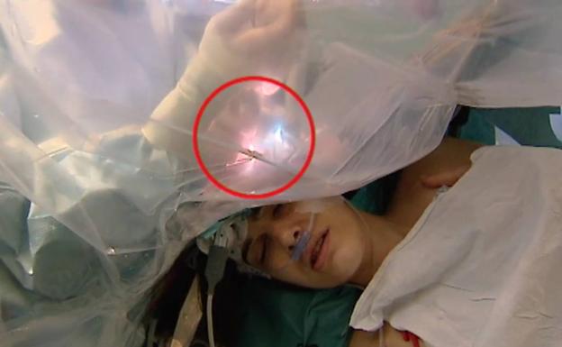 Entrevista a una paciente mientras le operan el cerebro