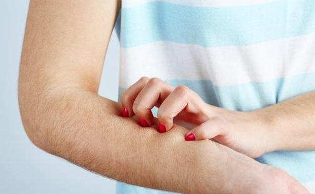 La razón por la que los mosquitos te pican siempre a ti