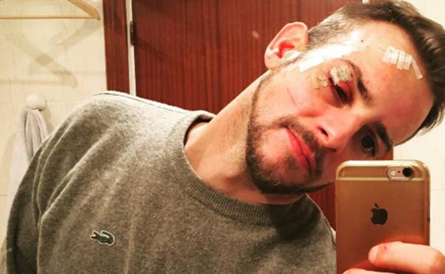 Piden tres años de cárcel para Álex Casademunt