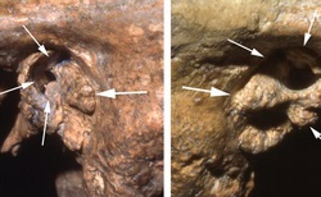 Un neandertal discapacitado recibió cuidados para llegar a la vejez