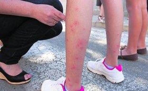 Alertan de la grave amenaza de las picaduras del mosquito tigre en la Región de Murcia