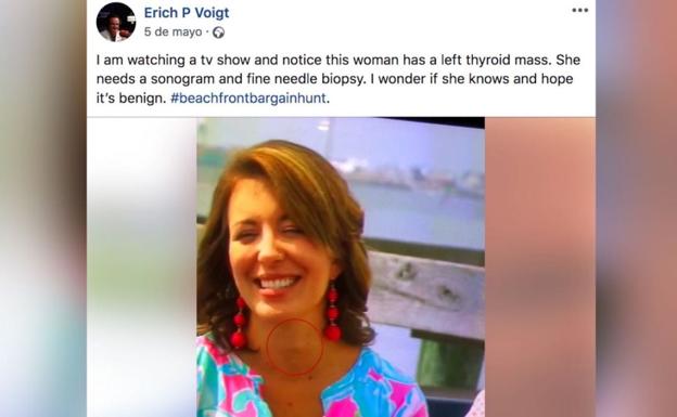 Un médico advierte a una mujer de que tiene cáncer de tiroides tras salir en televisión