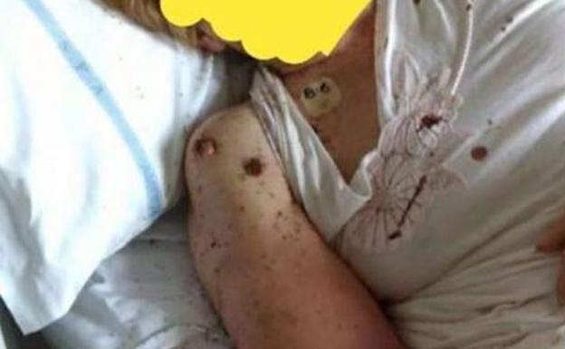 Encuentran a una paciende cubierta de hormigas en un hospital de Nápoles