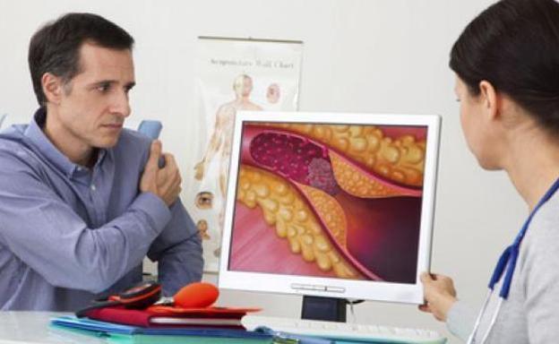 Identifican una proteína clave para mejorar el «colesterol bueno»