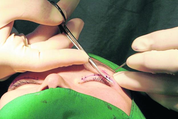 La peligrosa técnica cosmética que puede acabar en tragedia