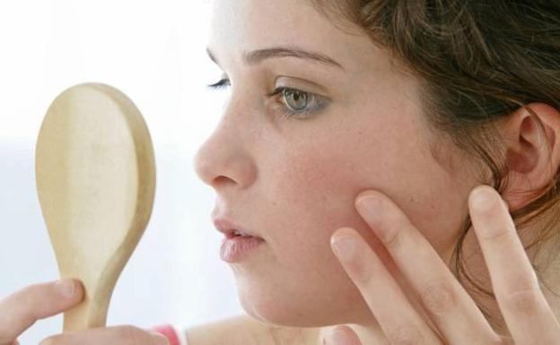 Los alimentos que no debes comer si tienes acné