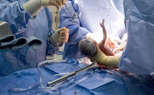 Uno de cada cuatro nacimientos en la Región de Murcia se produjo mediante cesárea en 2018
