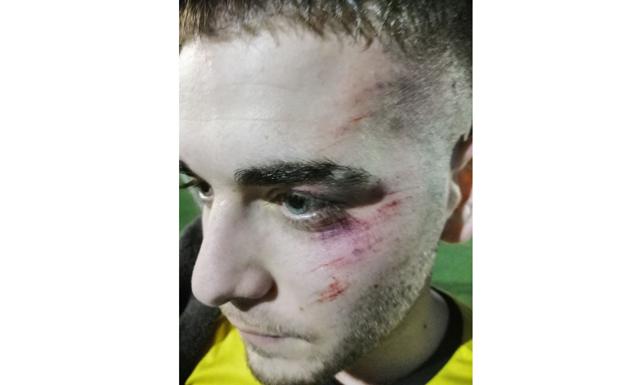 La Hoya pide la expulsión hasta final de temporada de un jugador del Roldán