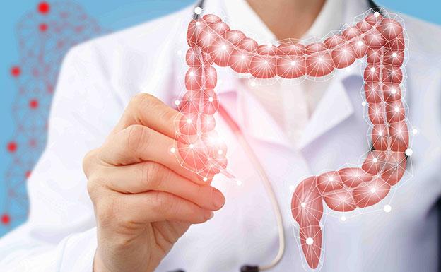 Cáncer de Colon, una enfermedad con detección temprana