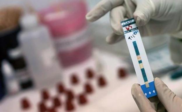 Pruebas rápidas de detección en saliva del VIH en Murcia de forma gratuita