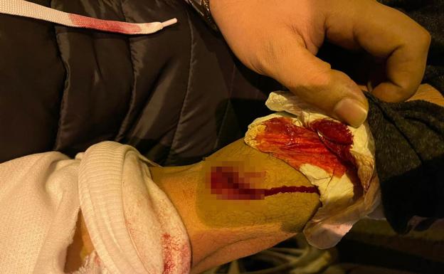 Acuchilla a dos clientes de un bar durante una pelea en San Javier