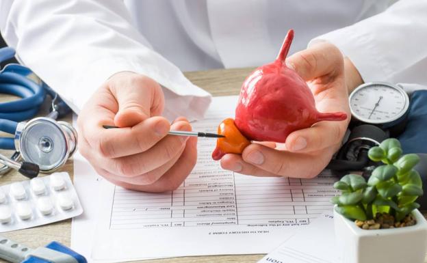 Ponle fin a la hiperplasia benigna de próstata: micción frecuente, escape ocasional e incluso sangrado