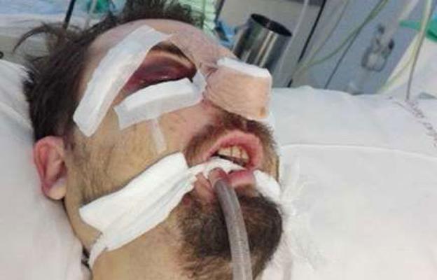 El acusado de asestar una brutal paliza a un joven en Santa Rita afronta quince años