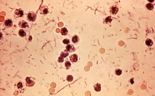 Estos son los síntomas de la contagiosa bacteria Shigella, que ya está en España