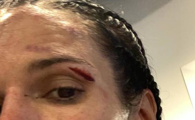 'Mari Bicho' regresa castigada de Milán: «Cecchi me dio muchos cabezazos»