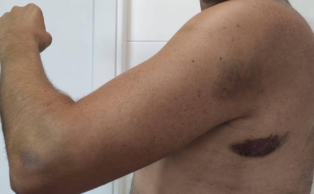 El médico agredido en un piso de Murcia: «Intentó asfixiar a mi compañero mientras le mordía en la cabeza»