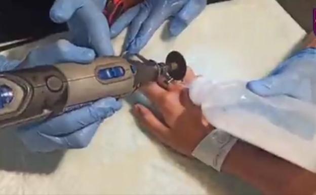 Un anillo atascado en un dedo provoca la intervención de los bomberos de Murcia