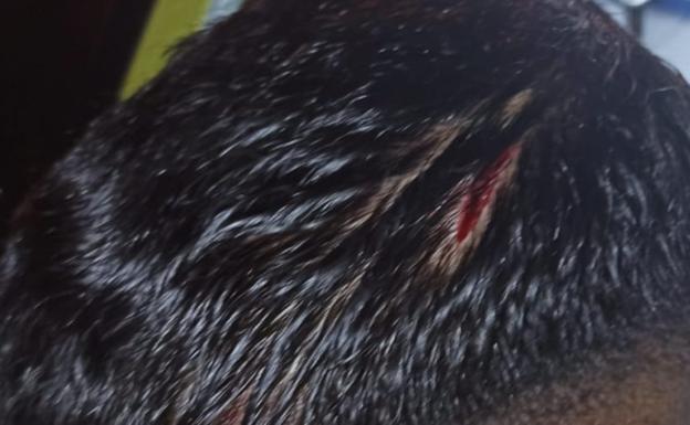 Hieren con una copa a un joven de 24 años en una discoteca de San Javier