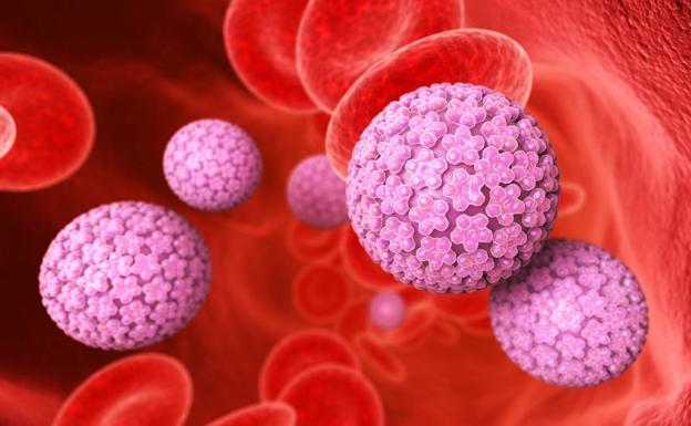 Virus del Papiloma Humano: ¿en qué casos es necesario realizar una conización?