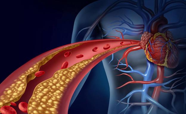 Este es el alimento clave para reducir los niveles de colesterol, según Harvard