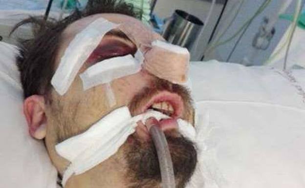 Juzgan al acusado de asestar una brutal paliza a un joven en el barrio murciano de La Fama