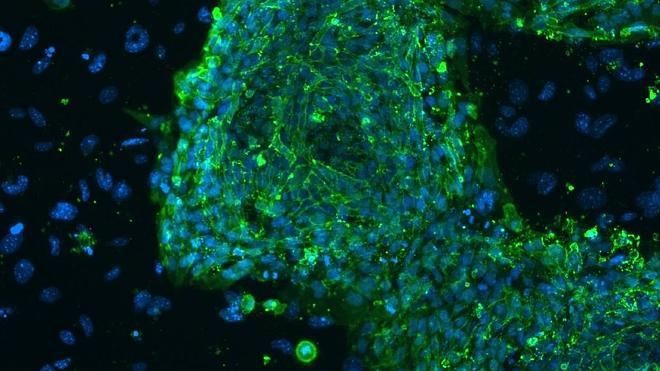 Investigadores usan células madre para tratar las lesiones cerebrales