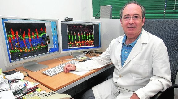 La UA inicia el primer estudio mundial sobre el párkinson con retinas humanas