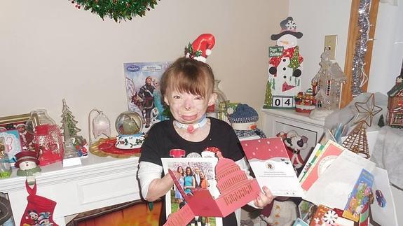 Katy Perry y los Obama cumplen el sueño de la niña quemada, Safyre