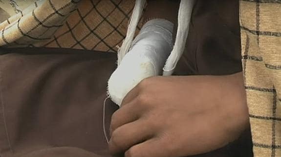 Un menor paquistaní se corta la mano voluntariamente tras «blasfemar contra Mahoma»