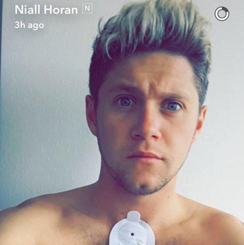 Niall Horan de One Direction, ingresado en el hospital