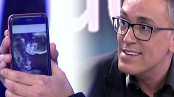 Kiko Hernández, colaborador de Sálvame, será padre de gemelas